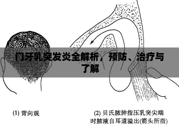 门牙乳突发炎全解析,预防、治疗与了解