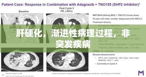 肝硬化,渐进性病理过程,非突发疾病