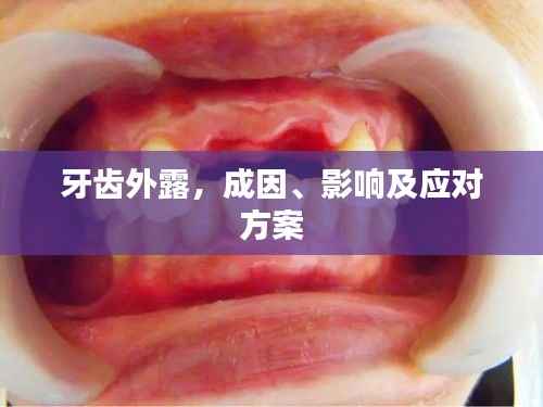 牙齿外露,成因、影响及应对方案